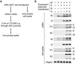 SARS Coronavirus Matrix Antibody in Western Blot (WB)