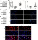 S100A9 Antibody in Immunocytochemistry (ICC/IF)