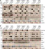 CBP Antibody in Western Blot (WB)