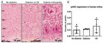 Phospho-JAK1 (Tyr1034) Antibody in Immunohistochemistry (Paraffin) (IHC (P))