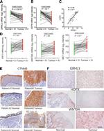 HOPX Antibody in Immunohistochemistry (IHC)