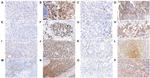 FAT4 Antibody in Immunohistochemistry (IHC)