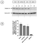 TMEM119 Antibody in Western Blot (WB)