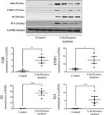 ETHE1 Antibody in Western Blot (WB)