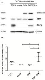 TCF3 Antibody in Western Blot (WB)