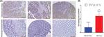 Endomucin Antibody in Immunohistochemistry (IHC)