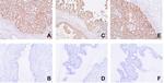 NCAPH Antibody in Immunohistochemistry (Paraffin) (IHC (P))