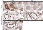 CSF1R Antibody in Immunohistochemistry (IHC)