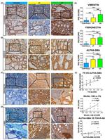 Vimentin Antibody in Immunohistochemistry (IHC)