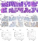 ZO-1 Antibody in Immunohistochemistry (IHC)