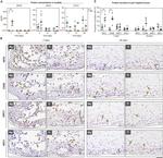 Arginase 1 Antibody in Immunohistochemistry (IHC)