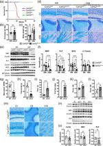 Lass2 Antibody in Western Blot (WB)