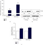 INPP4B Antibody in Western Blot (WB)