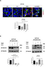 beta Catenin Antibody in Western Blot (WB)