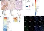 S100A4 Antibody in Immunohistochemistry (IHC)