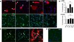 S100A4 Antibody in Immunocytochemistry (ICC/IF)