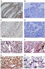 Collagen II Antibody in Immunohistochemistry, Immunohistochemistry (Paraffin) (IHC, IHC (P))