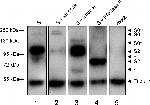 Human IgG (H+L) Secondary Antibody in Western Blot (WB)