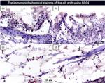 CD34 Antibody in Immunohistochemistry (IHC)