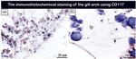 CD117 (c-Kit) Antibody in Immunohistochemistry (IHC)