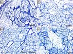 CD117 (c-Kit) Antibody in Immunohistochemistry (IHC)