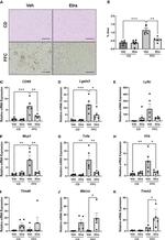 Galectin 3 Antibody in Immunohistochemistry (IHC)