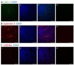 Galectin 3 Antibody in Immunohistochemistry (IHC)