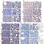 Endomucin Antibody in Immunohistochemistry (IHC)