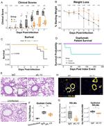 IL-13 Antibody in Neutralization (Neu)