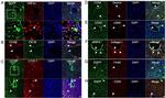 Desmin Antibody in Immunohistochemistry (IHC)