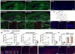 GFAP Antibody in Immunohistochemistry (Frozen) (IHC (F))