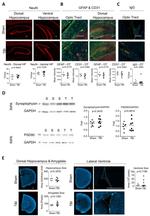 GFAP Antibody in Immunohistochemistry (Paraffin) (IHC (P))