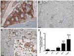 Versican V0, V1 Neo Antibody