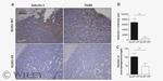 Galectin 1 Antibody in Immunohistochemistry (IHC)