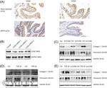 NOV Antibody in Immunohistochemistry (IHC)