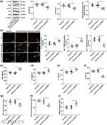 Nrf2 Antibody in Western Blot (WB)