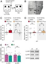 beta-1 Adrenergic Receptor Antibody in Western Blot (WB)