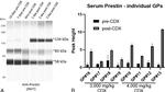 SLC26A5 Antibody in Western Blot (WB)