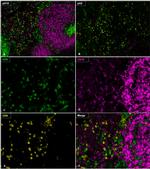 CD4 Antibody in Immunohistochemistry (IHC)