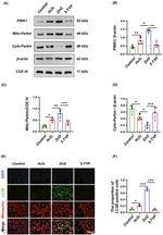 Parkin Antibody in Western Blot (WB)