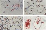 TNF alpha Antibody in Immunohistochemistry (IHC)