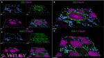 Glutamine Synthetase Antibody in Immunohistochemistry (IHC)