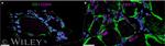 Glutamine Synthetase Antibody in Immunohistochemistry (IHC)