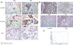 CYP27A1 Antibody in Immunohistochemistry (Paraffin) (IHC (P))