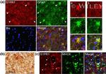 MHC Class II (I-A/I-E) Antibody in Immunohistochemistry (IHC)