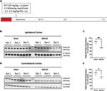 OATP1 Antibody in Western Blot (WB)