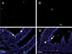 IP3 Receptor 1 Antibody in Immunohistochemistry (Paraffin) (IHC (P))