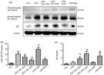 Phospho-NFkB p100 (Ser866, Ser870) Antibody in Western Blot (WB)