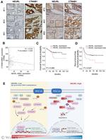 beta Catenin Antibody in Immunohistochemistry (IHC)