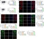 B-Raf Antibody in Western Blot (WB)